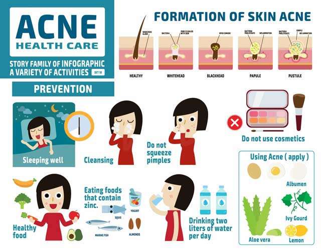 How To Get Rid Of Acne Scars | Femina.in