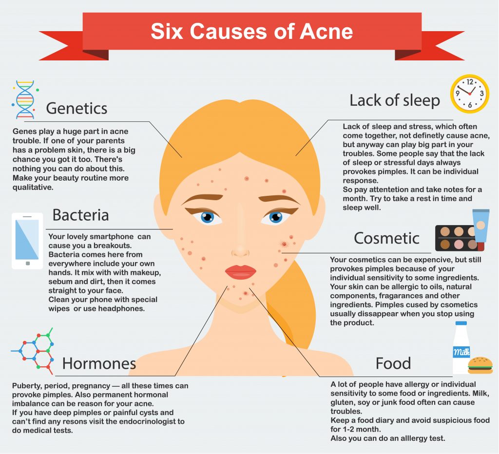 10 Skin Care Hacks To Prevent Acne | The Naked Chemist