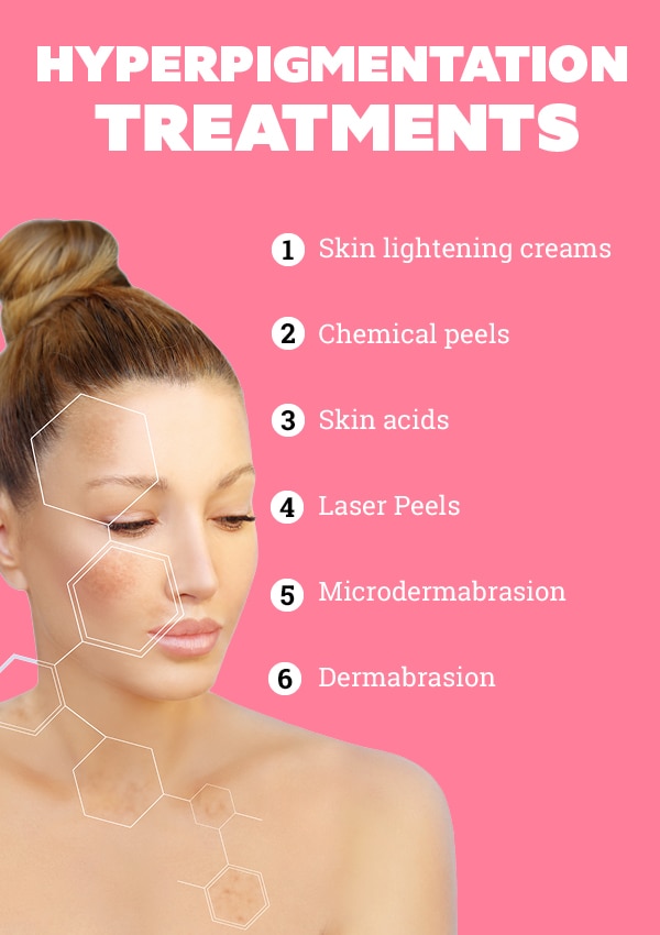 Hyperpigmentation Treatments: Causes and What is Hyperpigmentation? | Be Beautiful India
